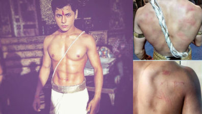 Siddharth Nigam  injured on the set of Chandra Nandni