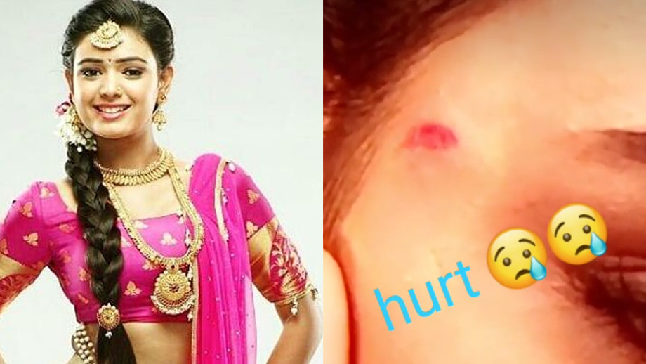 Neha Solanki injured on the sets of Mayavi Maling