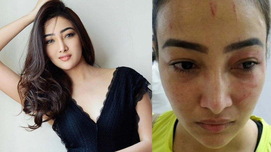 Naamkarann fame Nalini Negi files FIR against former roommate for physical assault