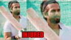 OMG: Shahid Kapoor INJURED while shooting for Jersey