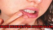 Home Remedies To Get Rid Of Mouth Ulcers