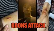 OMG: Goons attack Bigg Boss fame Asim Riaz, injure him