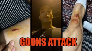 OMG: Goons attack Bigg Boss fame Asim Riaz, injure him