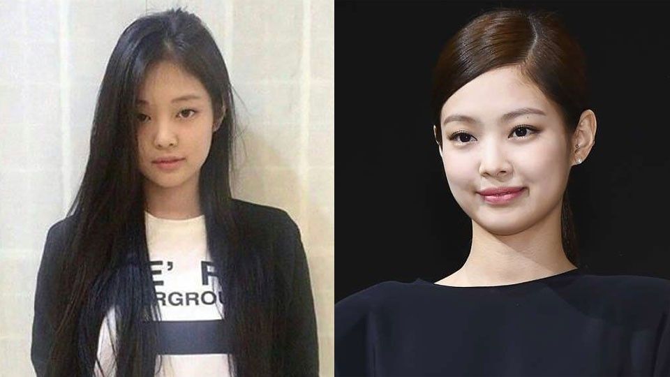 BLACKPINK’s Jennie, Jisoo: Before and After Alleged Plastic Surgery