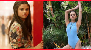 Why Selena Gomez Shows Off Her Scar Openly?