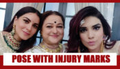 Check Out: Anjum Fakih and Shraddha Arya Pictures With Injury Marks