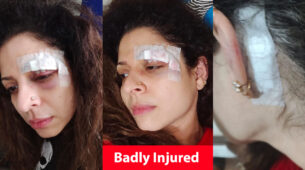 OMG: Apna Time Bhi Aayega Actress Tannaz Irani badly injured, shares pictures