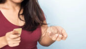Excessive Hair Loss? Here Are the Best Ways To Deal With It