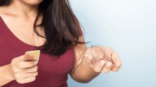 Excessive Hair Loss? Here Are the Best Ways To Deal With It