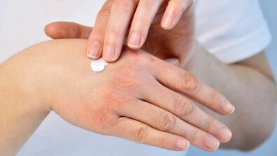 Damaged Skin In Winter? Know Everything To Take Care Of Your Skin