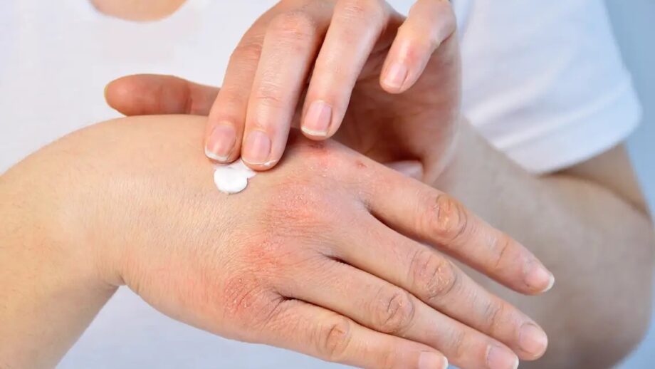 5 Common Skin Care Mistakes We Must Avoid