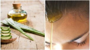 Home Remedies For Psoriasis