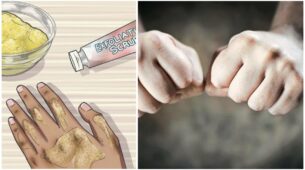 Home Remedies To Lighten Your Knuckles