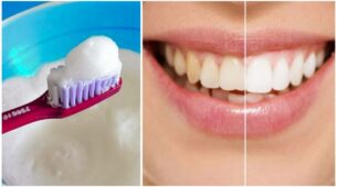 Home Remedies To Whiten Your Teeth