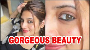 Perfect Skin Is A Myth: Nusrat Jahan’s embraces skin with pimples & imperfections, see photos