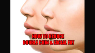 This Is How You Can Reduce Your Double Chin And Facial Fat