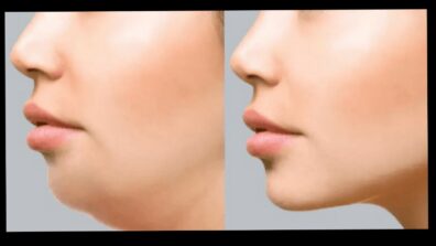 5 Exercises To Get Rid Of Bulgy Double Chin