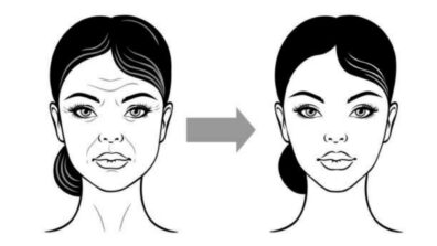 Exercises To Keep Facial Wrinkles At Bay