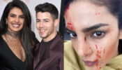 Dead or Alive: Priyanka Chopra caught with bloodied face