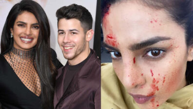 Dead or Alive: Priyanka Chopra caught with bloodied face