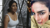 OMG: Priyanka Chopra shares a photo of her bloodstained face, is she seriously injured?