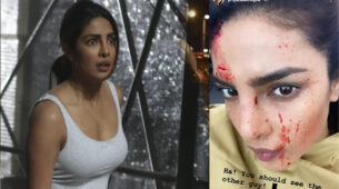 OMG: Priyanka Chopra shares a photo of her bloodstained face, is she seriously injured?