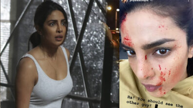 OMG: Priyanka Chopra shares a photo of her bloodstained face, is she seriously injured?