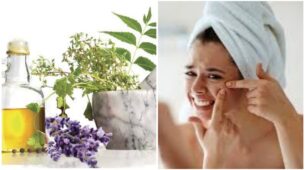 Face Care: What’s Worse Than Spotting Pimples On Your Face? Follow Some Home Remedies To Get Rid Of!