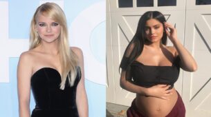 From Kylie Jenner To Anna Faris: These 5 Celebrities Publicly Admitted Having Done Fillers