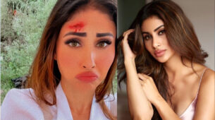 OMG: Mouni Roy shares sad bloodstained photo from movie sets, is she seriously injured?
