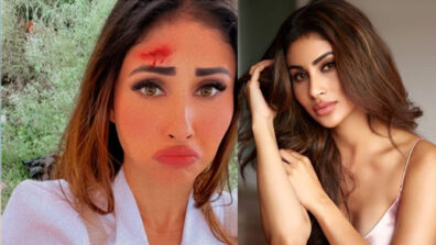 OMG: Mouni Roy shares sad bloodstained photo from movie sets, is she seriously injured?