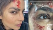 OMG: Priyanka Chopra injures herself on the sets of Citadel, shares photos of her bloodstained face