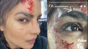 OMG: Priyanka Chopra injures herself on the sets of Citadel, shares photos of her bloodstained face