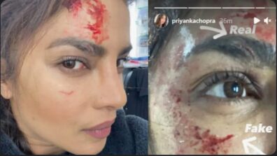 OMG: Priyanka Chopra injures herself on the sets of Citadel, shares photos of her bloodstained face