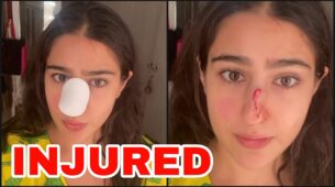 OMG: Sara Ali Khan’s nose gets severely injured, fans pray for her speedy recovery