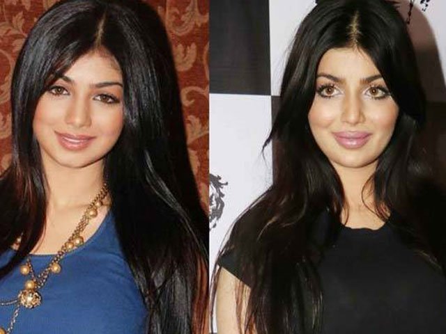 When Ayesha Takia Got Brutally Trolled Over Speculations Of A Failed Lip Job - 0