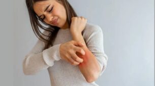 5 Homemade Remedies To Cure Skin Itching, See Here