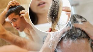 Do You Find Yourself Struggling With Hair Loss? Here Are Effective Ways To Treat Hair Loss, Check Out