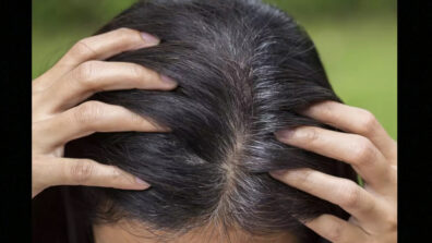 Natural Remedies To Get Rid Of White Hair Forever