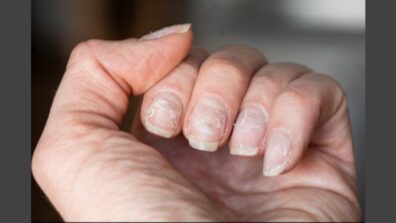 Suffering From Brittle Nails? View Out These Remedies!