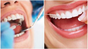 Want Healthy Teeth And Gums? Here Are 5 Mistakes That You Should Avoid To Maintain Oral Health