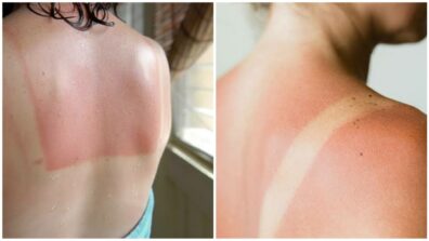 Worried About Tanning & Sunburns? Check Out How To Avoid It