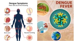 5 Home Remedies To Recover From Dengue Fever You Must Know