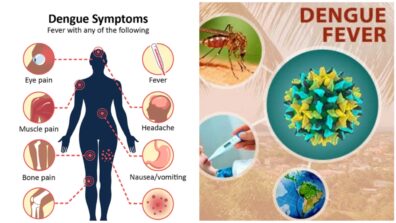 5 Home Remedies To Recover From Dengue Fever You Must Know