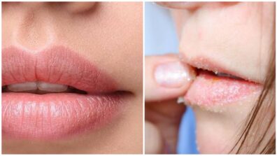 5 Steps To Get Soft & Pink Lips, Try These Hacks!