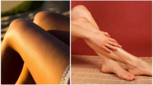 Are You Tired Of Strawberry Legs? Here Are A Few Tips To Get Rid Of Them Right Away