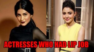 Before and after pictures of actresses who had lip job done, from Anushka Sharma to Shruti Haasan and more