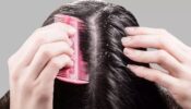Homemade Dandruff Shampoo Recipe To Fight Dandruff Instantly