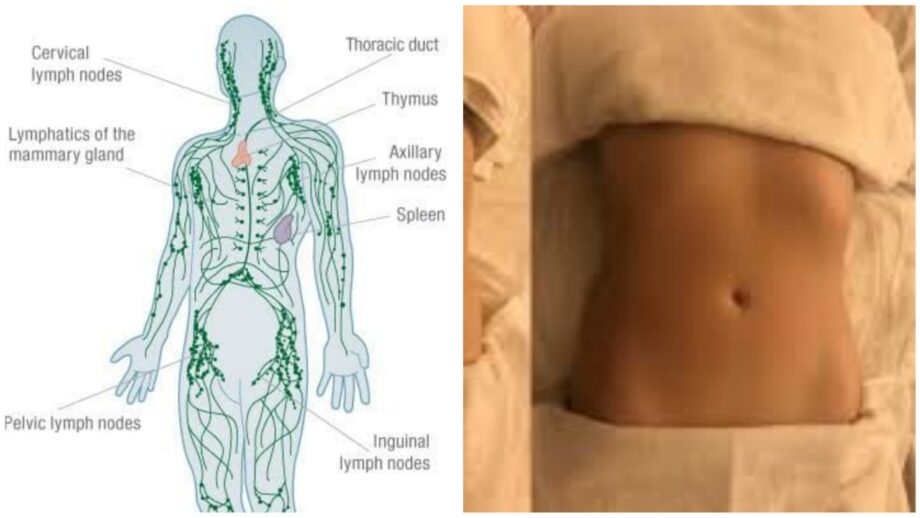 3 Movements To Improve Lymphatic Drainage 542839