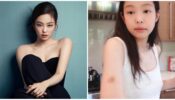 Jennie From Blackpink Got A Bruise In An Unpredictable Way, Find Out